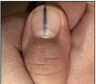 1556065902758547.png 444.png