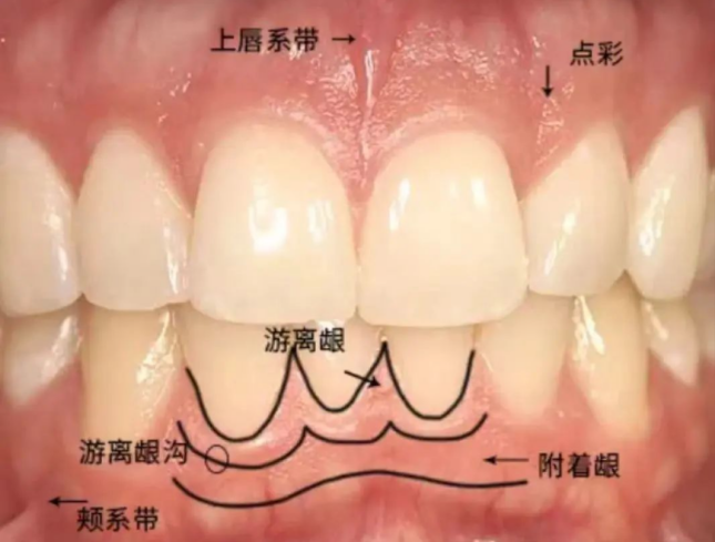 2图4.png